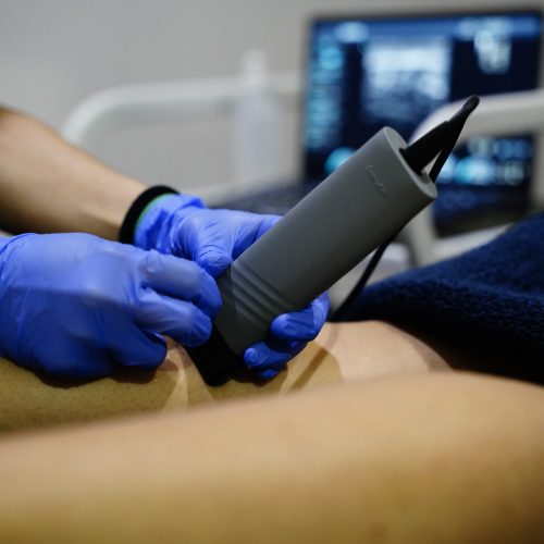 Fisioterapia tras Accidente de Tráfico en Elche